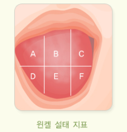 윈켈설태지표부위