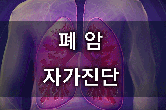폐암자가진단대표이미지